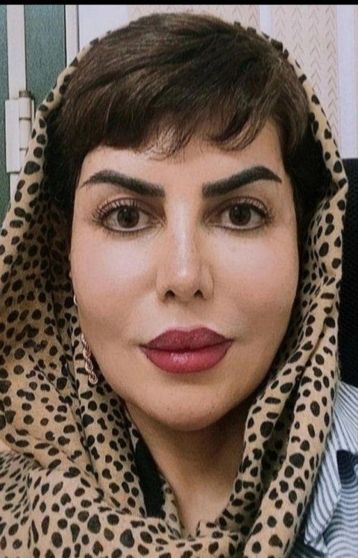 لیلا قاسمی جوانسازی و کلاژن سازی  واژن باDBD پلاسماوED پلاسما،درمان عفونت مقاوم واژن و زخم دهانه رحم  با ازون تراپیDBD پلاسما،معاینه پرده  بکارت ،آیودی گذاری ،تست پاپ اسمیر ،قرص اورژانسی  ،تنبلی تخمدان ،ناباروری ، پرده بکارت هایمن و گوا