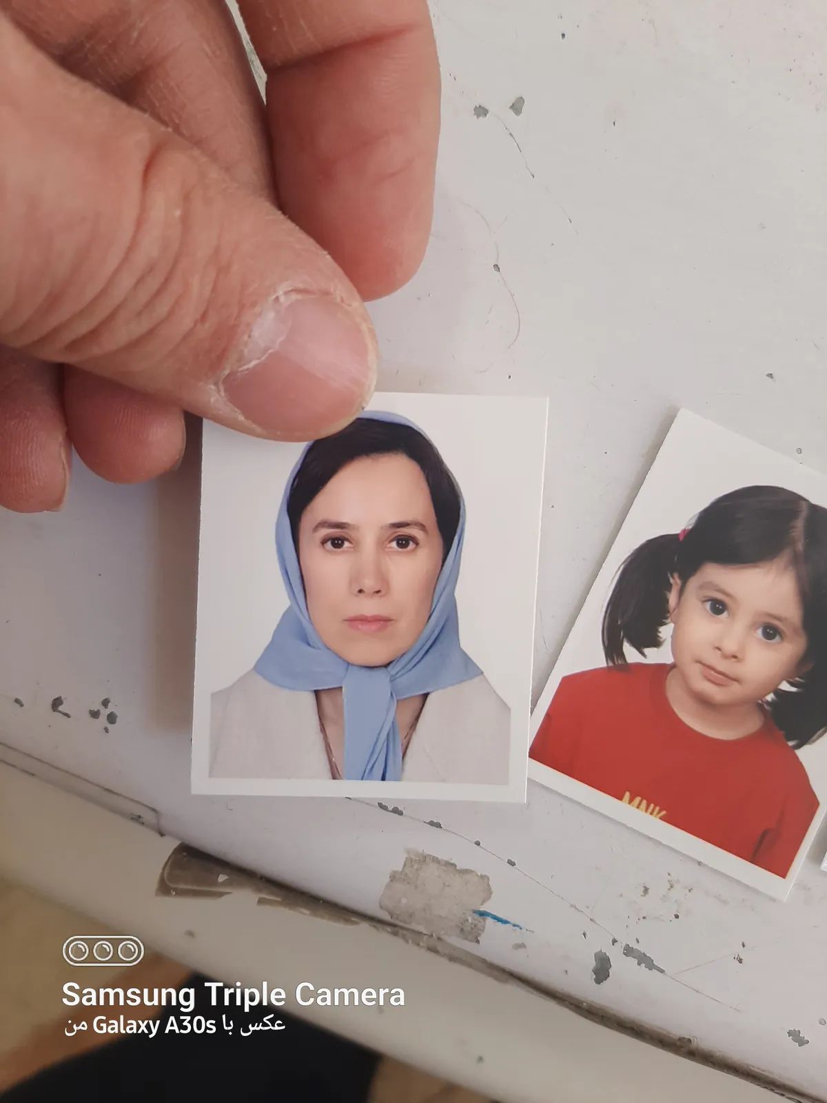 ستاره ثاقب حسین پور فلوشیپ جراحی زیبایی و انحراف چشم, فلوشیپ استرابیسم