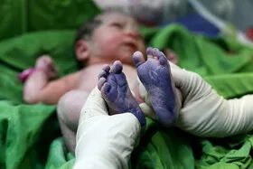 دکتر پروین ملازهی