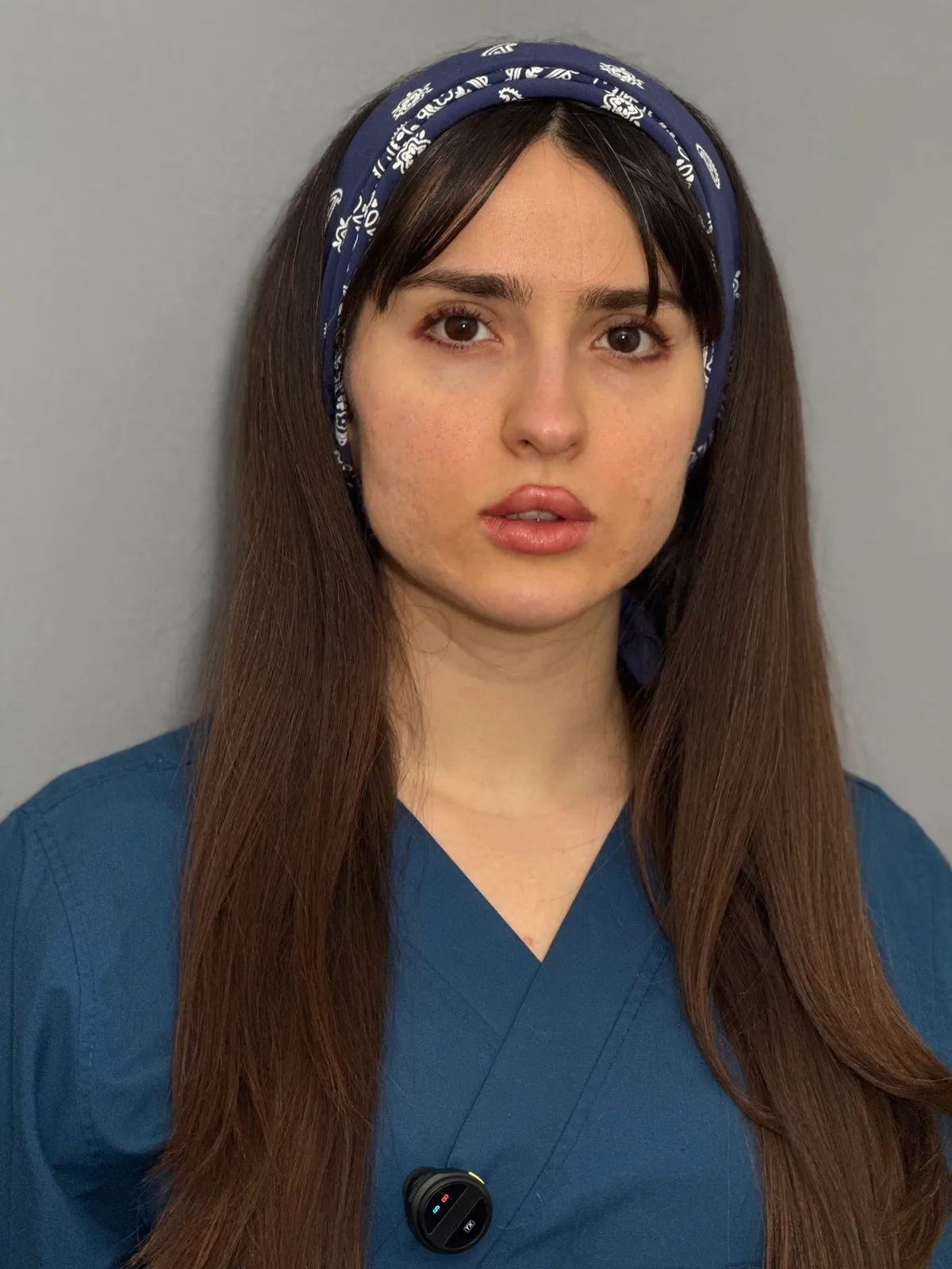 دکتر مهسا زبیری دکترای حرفه ای پزشکی | فیلر | لاغری| بوتاکس | نخ | جوانسازی | مزوتراپی | آکنه | اسکار | ریزش مو | اندولیفت | هایفو | PRP | لیزر