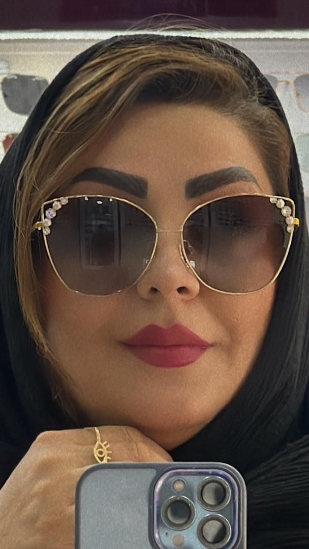 دکتر نسرین گلوی کارشناس بینایی سنجی